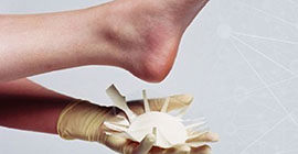 Clinician applying Tagerderm to a pressure injury