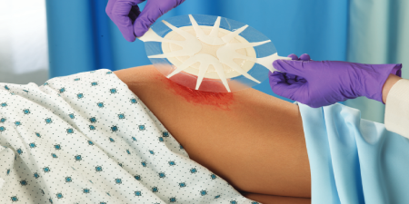 A WOCN providing wound care and management to a patient
