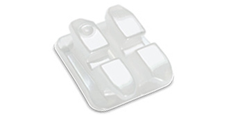 3M Clarity Ceramic brackets
