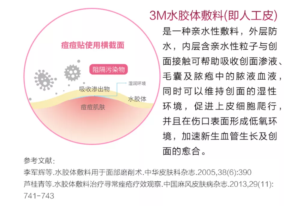 3M水胶体敷料(人工皮)应用于痘痘贴