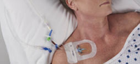 Stopping sepsis in its tracks