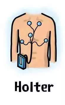 Holter检查