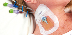 patients neck, bloodstream infections
